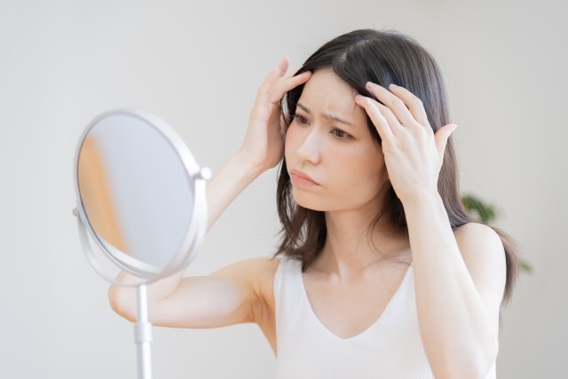 円形脱毛症とは？－皮膚科専門医が解説